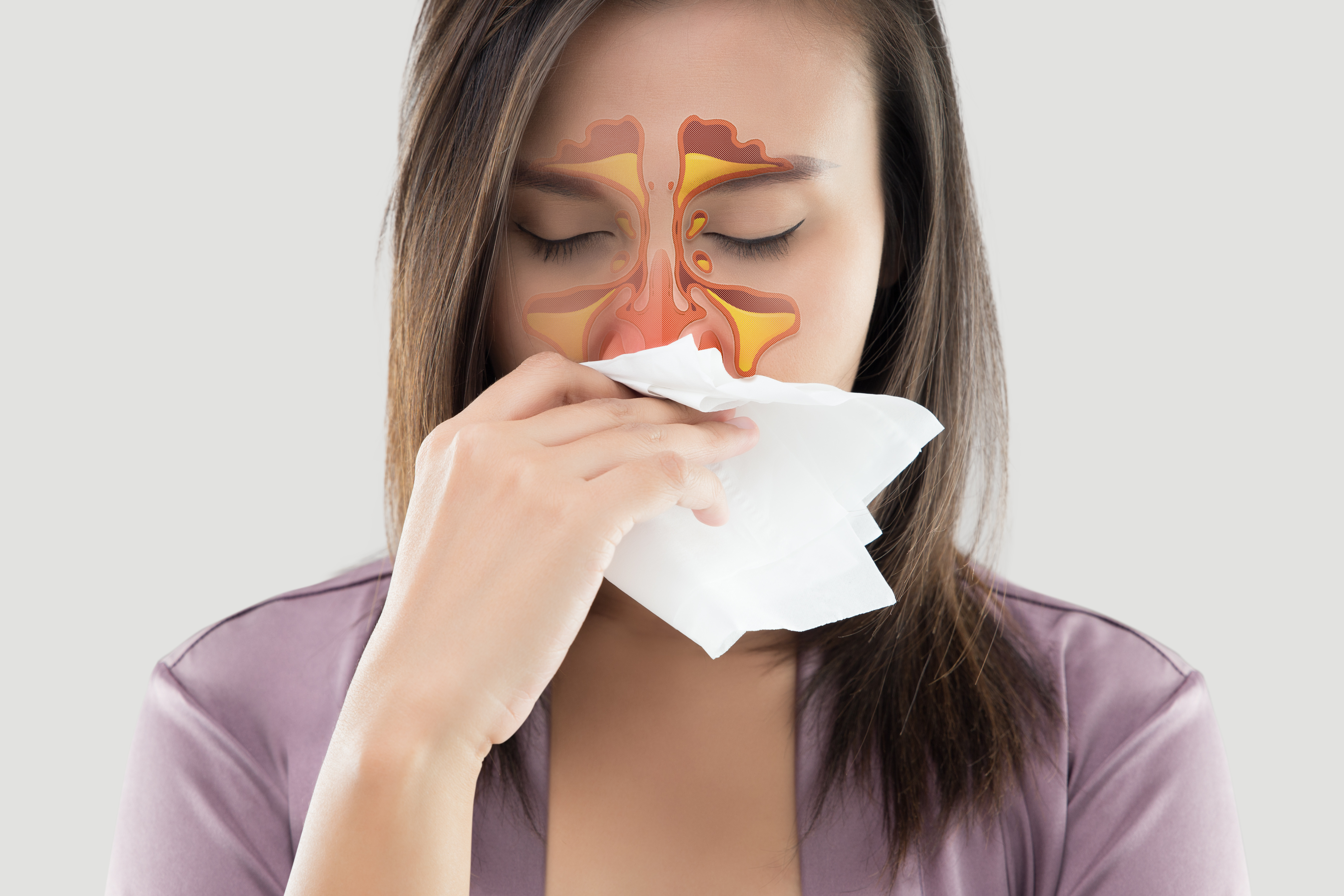 Will Chronic Sinusitis Go Away On Its Own